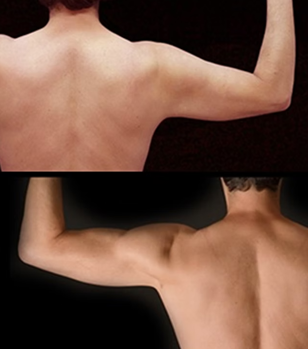 Antes / Después 2