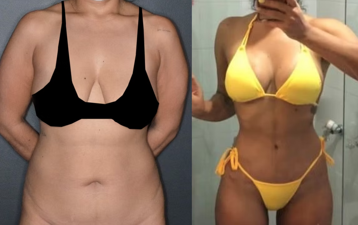 Antes / Después 6