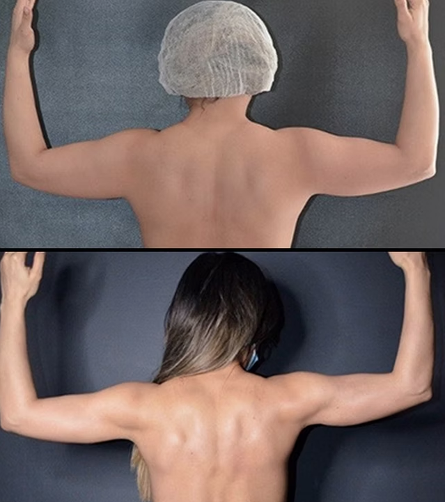 Antes / Después 4