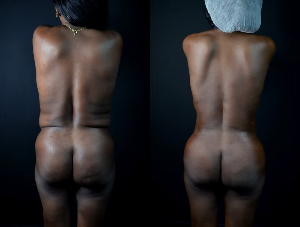 Antes / Después 3