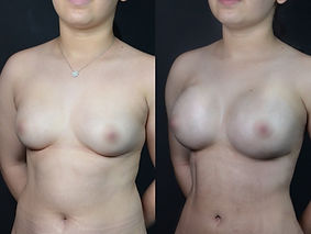Antes / Después 6