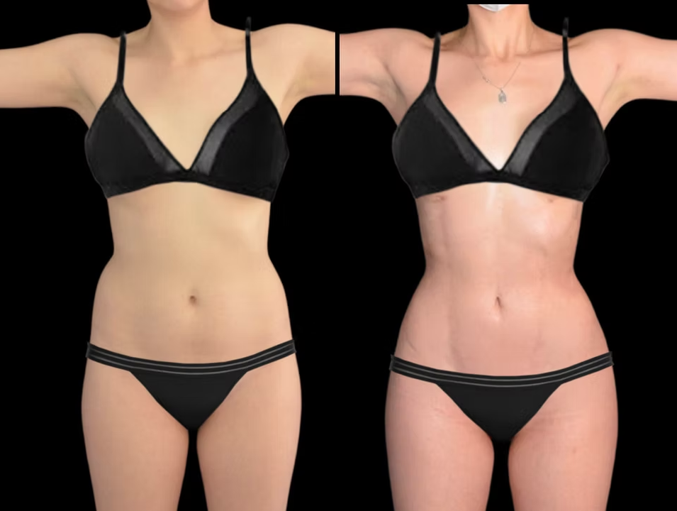 Antes / Después 3