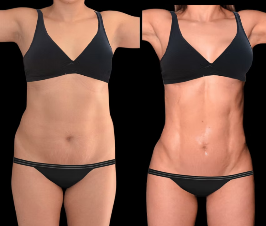 Antes / Después 7