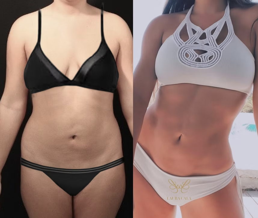 Antes / Después 6