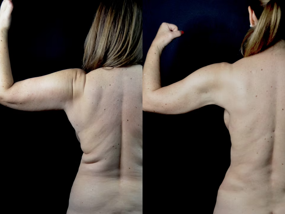 Antes / Después 2